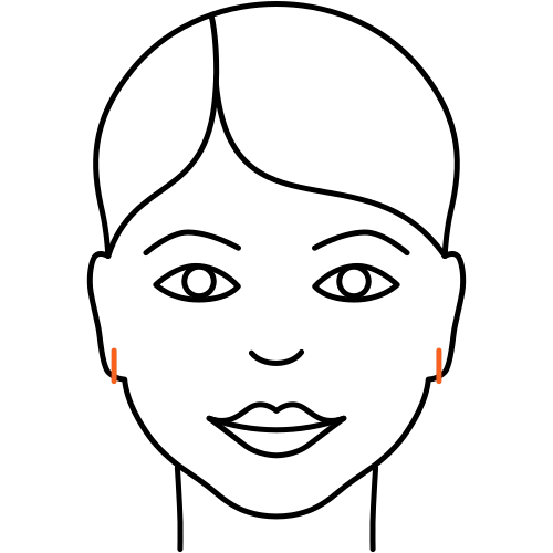 Ohrläppchen (Ohrloch) -Korrektur – Fakten