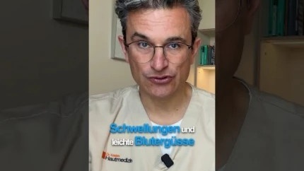 Fadenlifting: Wie lange hält es? Welche Risiken gibt es? | Dr. med. Robert Kasten
